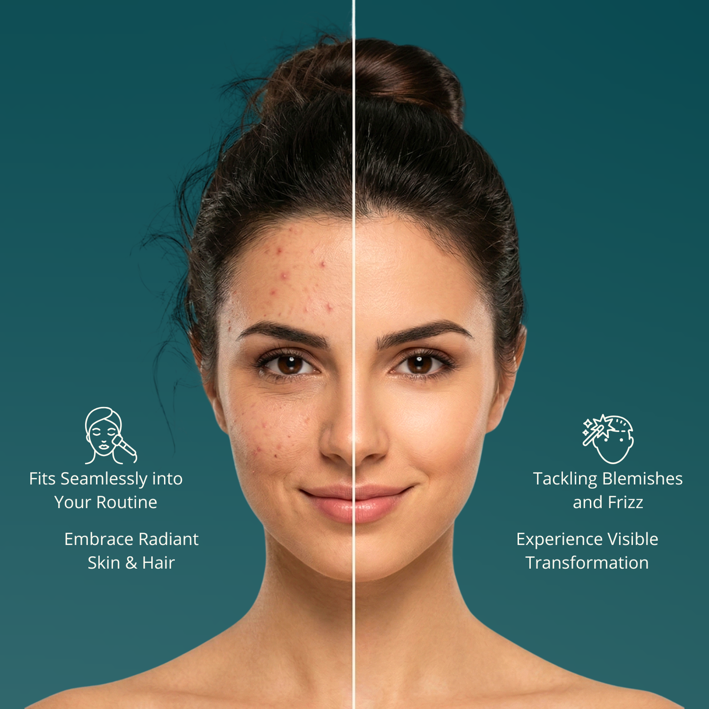 Dispositivo de alta frecuencia 4 en 1 - Tratamiento facial y capilar